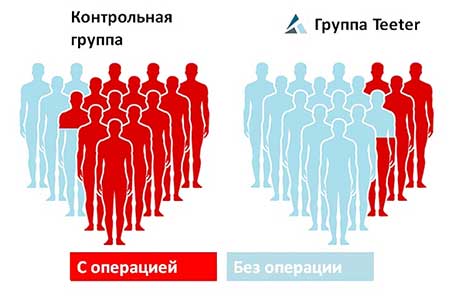 Ишиас (Невралгия седалищного нерва)